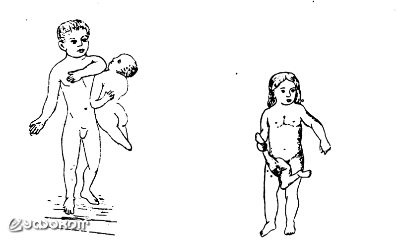 Рисунки из статьи В. Шимкевича «Двойные уродства», опубликованной в журнале «Естествознание и география» в 1898 году (№7).