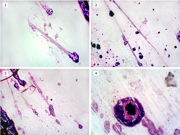 Микрофотографии исследуемого образца, окр. по Паппенгейму: 1 – спорангий, об. ×20; 2, 3, 4 – гифы гриба, об. ×5.