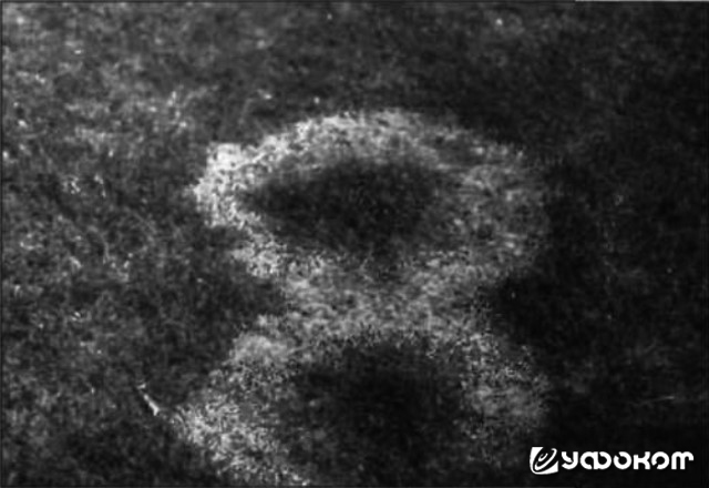Рис. 7. Интересная «восьмерка» из эльфовых колец, образованная грибом Marasmius oreades. Фото Левана Р. Эванса.