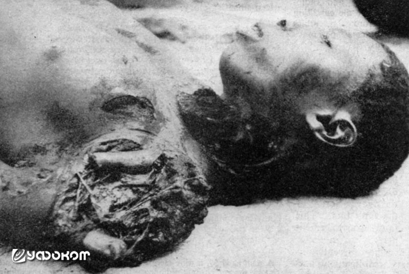Верхняя часть тела погибшего от восходящего разряда. Верхняя часть тела погибшего от восходящего разряда.