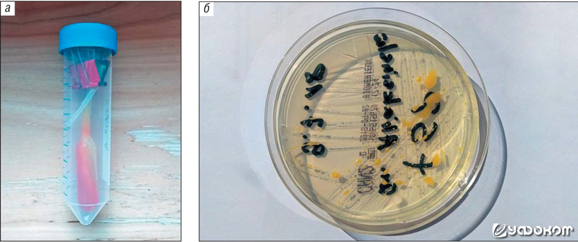 Рис. 8. Образец темнокрасных выделений с иконы Иверской Божьей матери из Клина (а) и пример питательной среды, исполь зованной для бактериологического и микологического исследования данного образца (б).