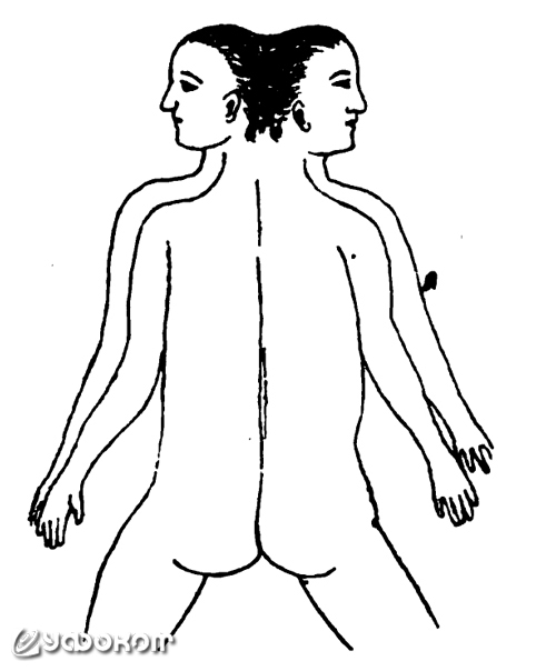 Рисунок из статьи В. Шимкевича «Двойные уродства», опубликованной в журнале «Естествознание и география» в 1898 году (№7). Подписан как: «Янусообразный двойной урод с двумя равномерно развитыми лицами».