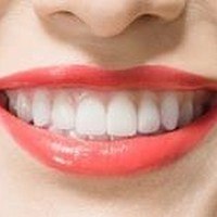 Элайнеры Инвизилайн - лучшее ортодонтическое лечение для исправления прикуса