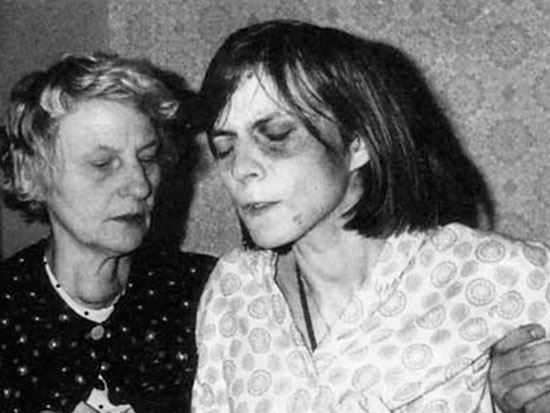 Рис. 3. Немецкая одержимая Аннелиза Мишель и её мать  (фото во время очередного приступа).