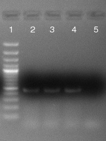 Рис. 3. Электрофореграмма продукта ПЦР с праймерами mcb398 и mcb869. 1 – маркер GeneRuler 100 bp Plus DNA Ladder, 2, 3, 4 – продукт ПЦР, 5 – контроль без матрицы