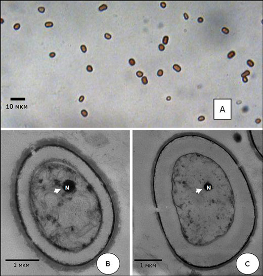 Изображения клеток до нагревания, полученные с помощью оптического (сверху) и просвечивающего электронного микроскопов. N - структура, напоминающая ядро.