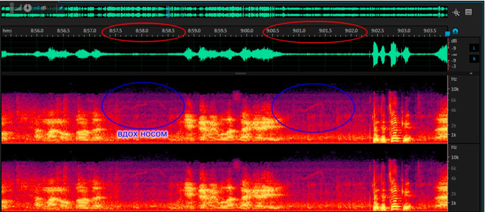 Перед каждой фразой, на спектрограмме виден глубокий вдох носом.