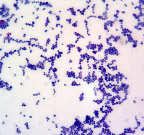 Грамположительные микроорганизмы, развившиеся на среде Сабуро.