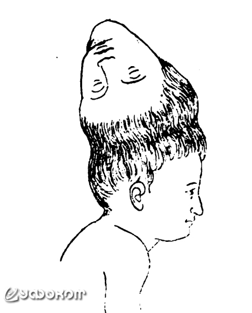 Рисунок из статьи В. Шимкевича «Двойные уродства», опубликованной в журнале «Естествознание и география» в 1898 году (№7).