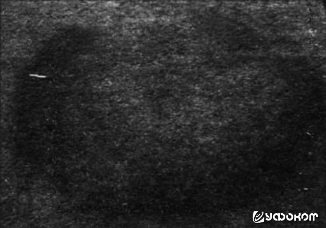 Рис. 1. «Загадочное кольцо НЛО», найденное на лужайке в Кьюпи, Пуэрто-Рико. Фото Люси Гусман (www.ovni.net).