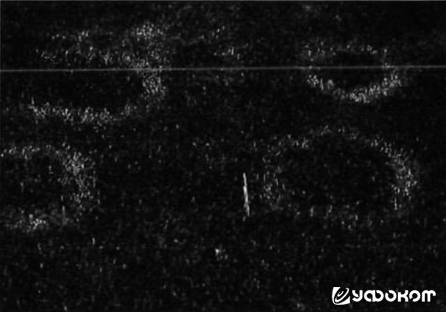 Рис. 3. Черная ножка у газонной травы, вызванная грибом рода Rhizoctonia. Фото Дж. Дрю Смита.